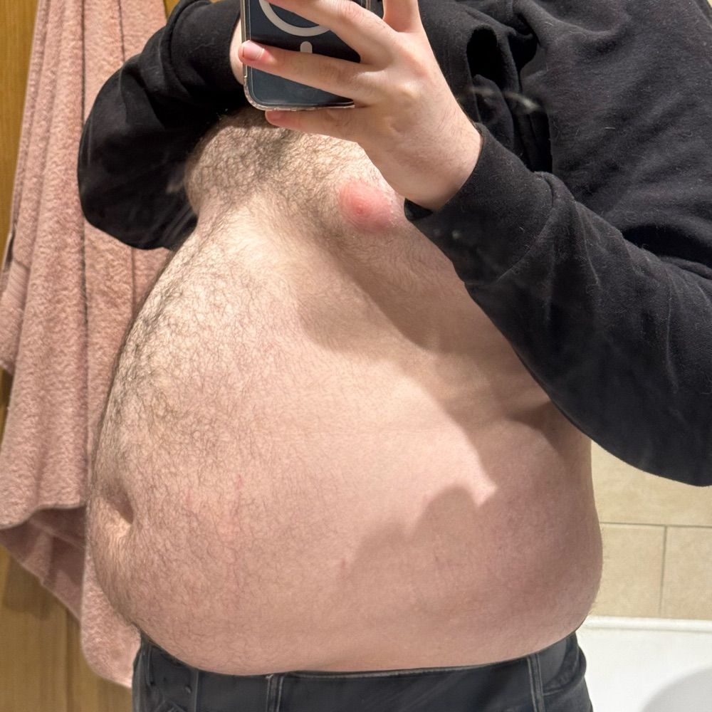 AntiBear