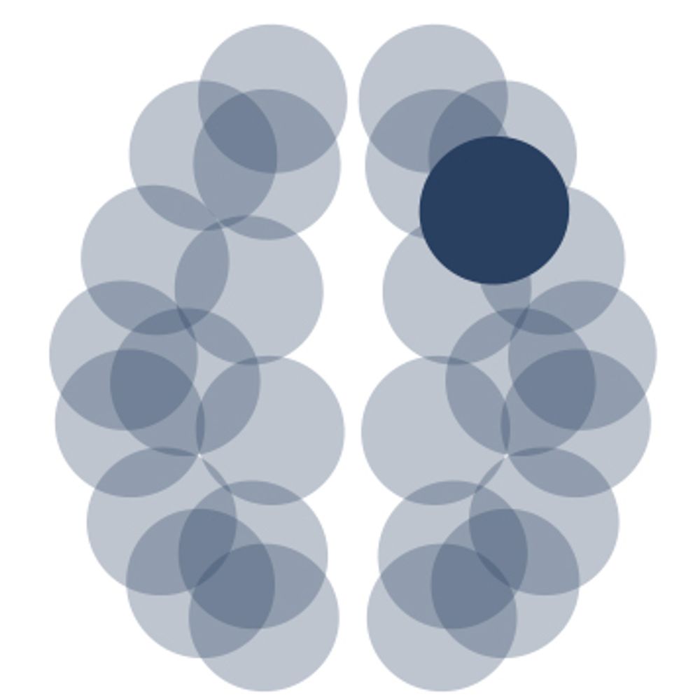 Institute for Stroke and Dementia Research (ISD)