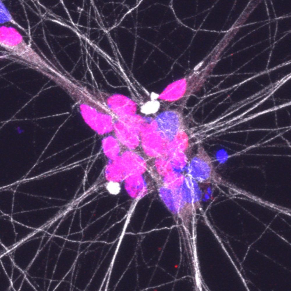 Oxford MND Research