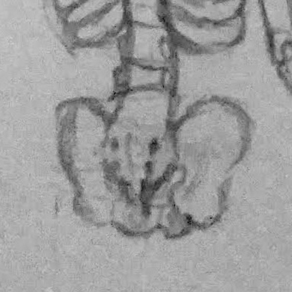 bone rot 🔞