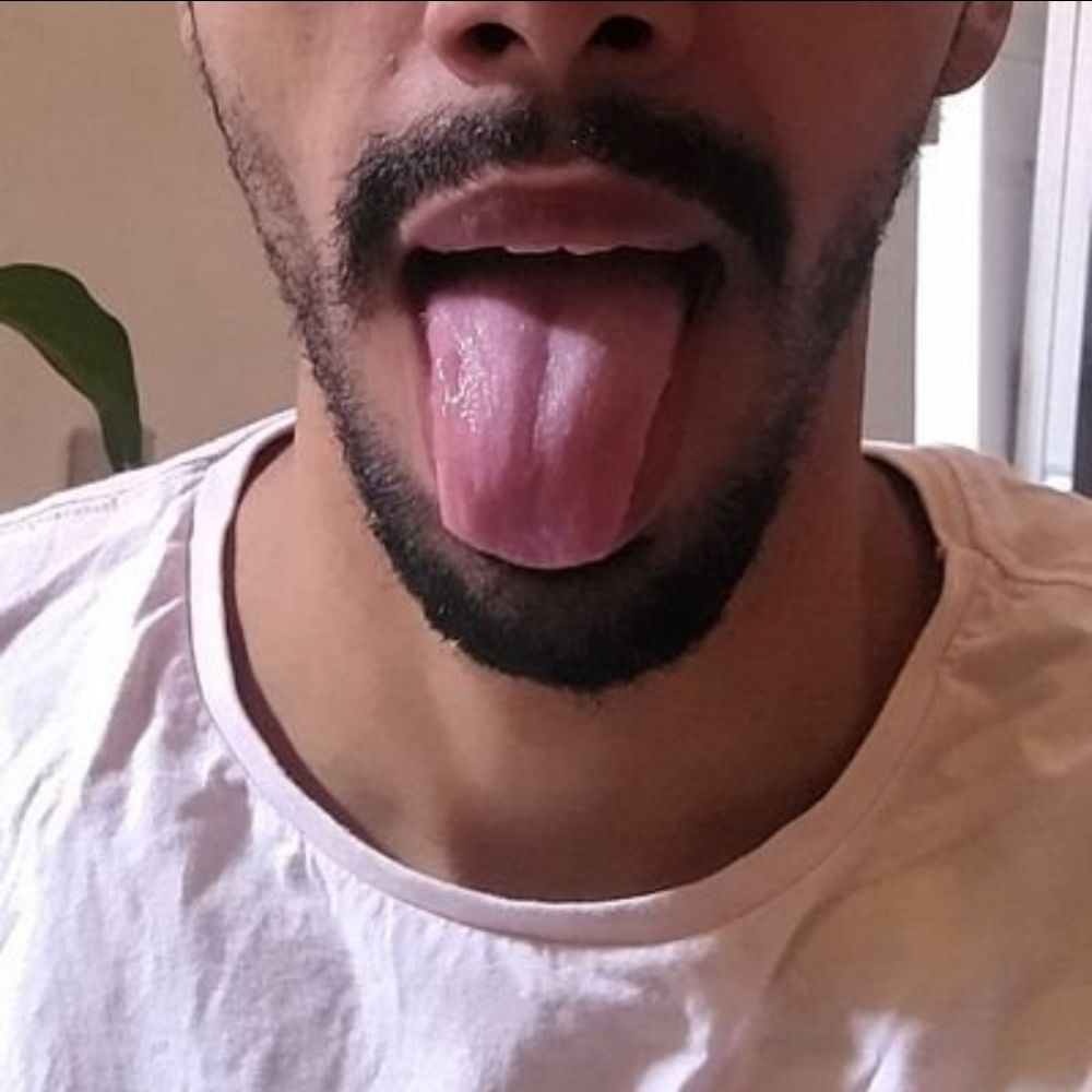RB