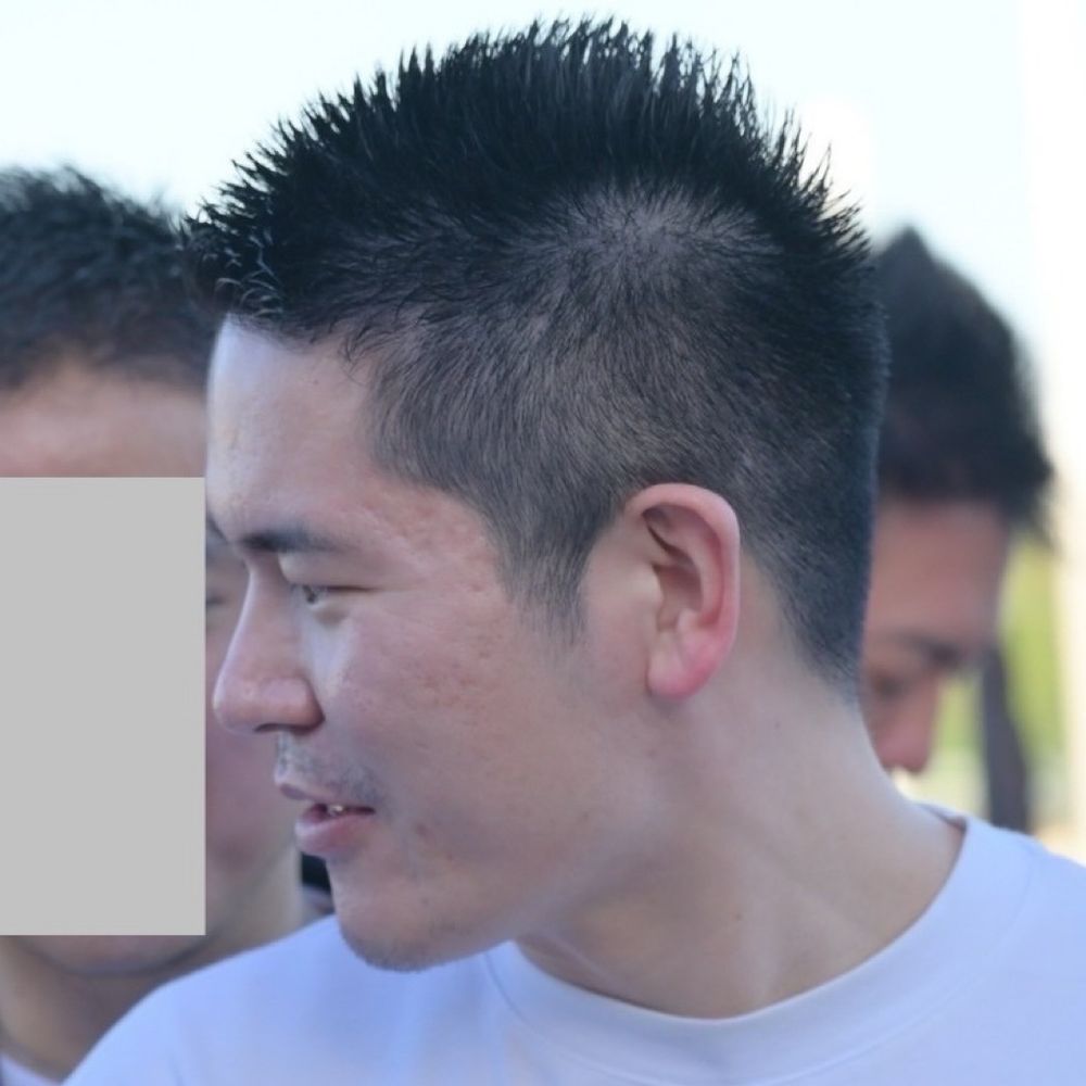 瑛輔