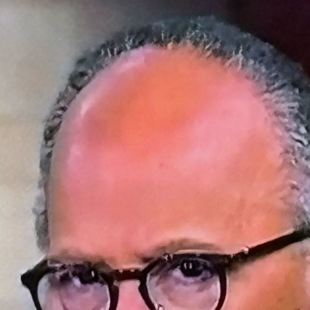 Lester Holt Forehead
