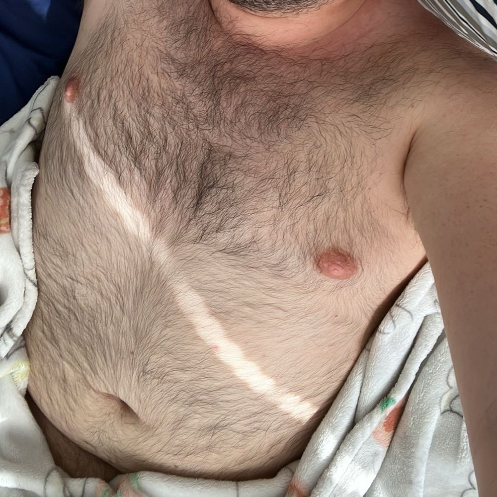 C 🙊