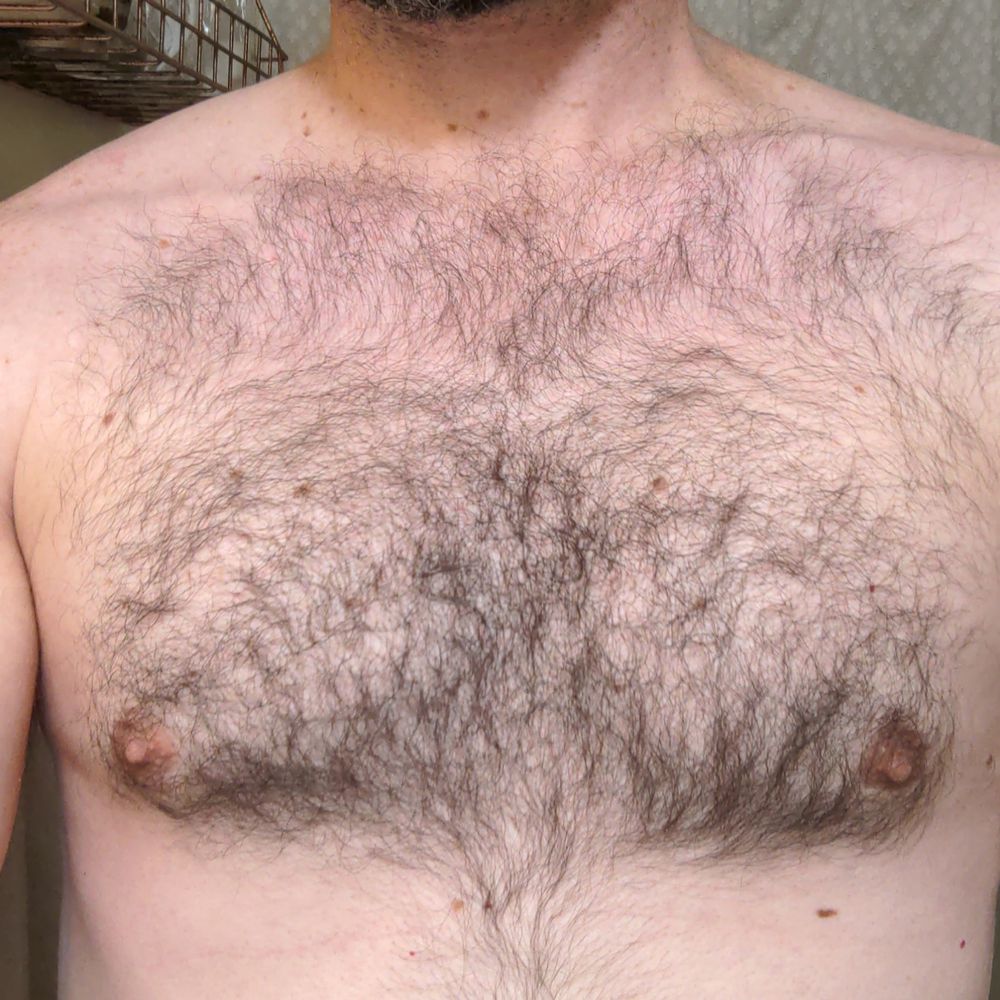 FT
