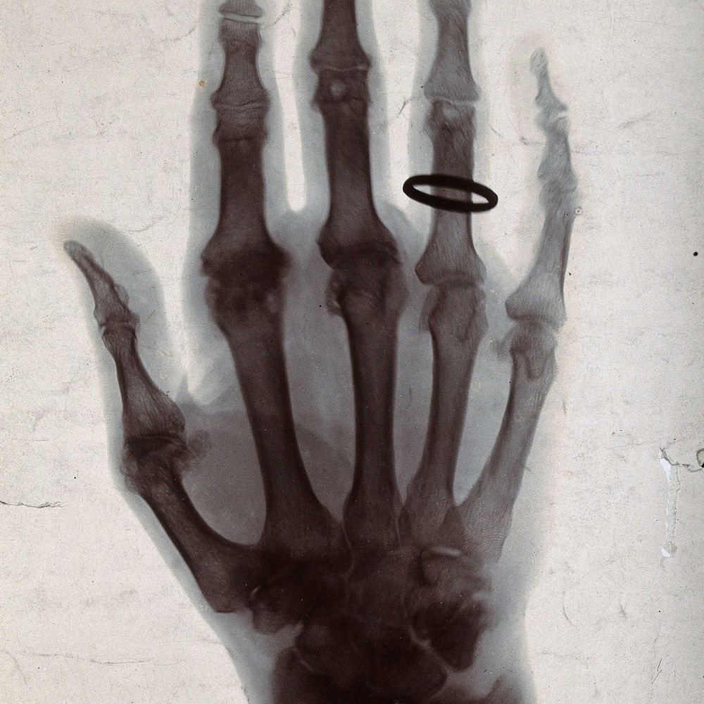 The Victorian Hand