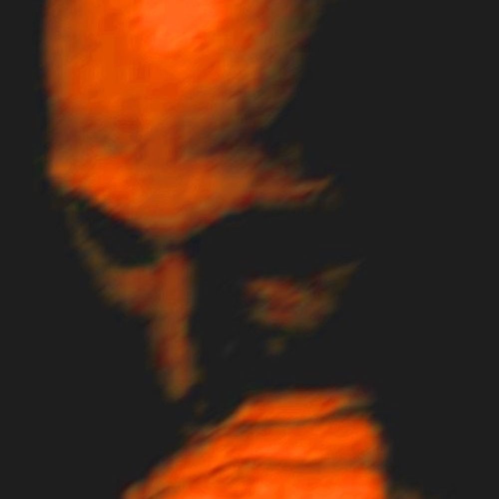 blakkorange