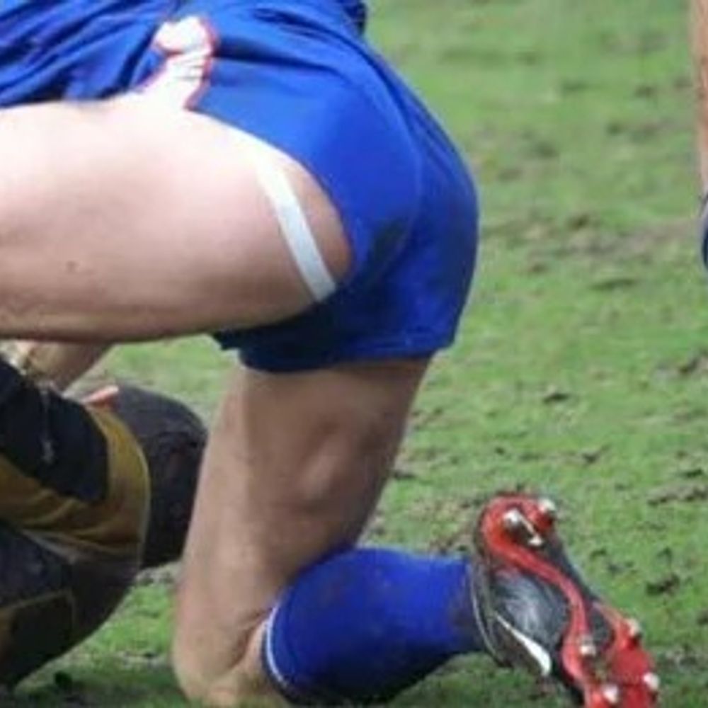 Rugbyarse