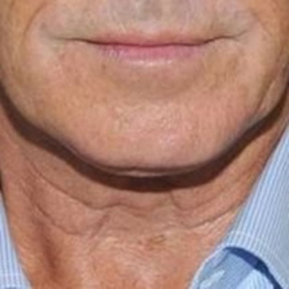 Perversito