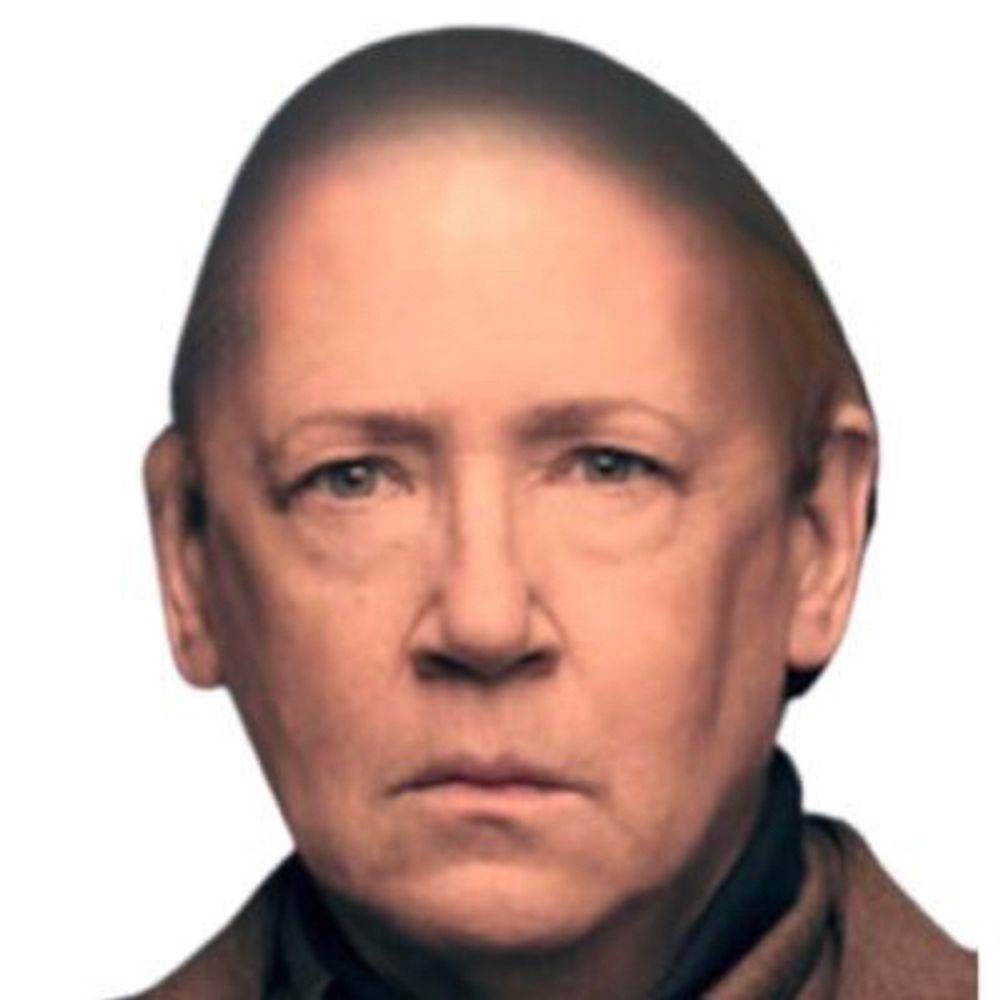 bald ann dowd