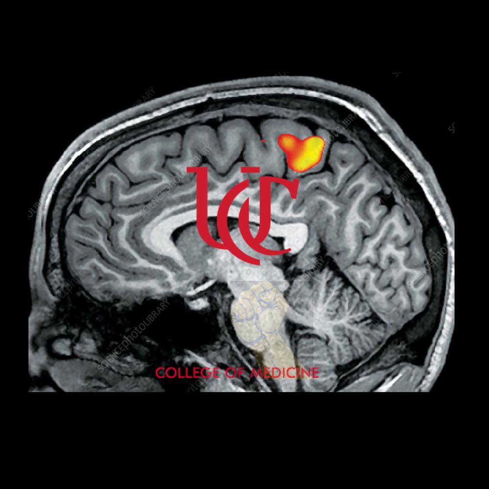 University of Cincinnati Radiology Residency
