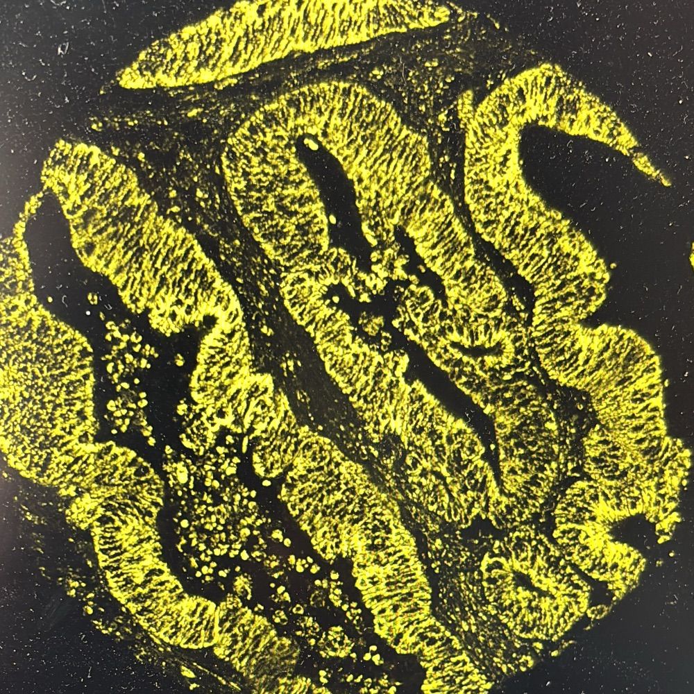 MitoCancer Lab