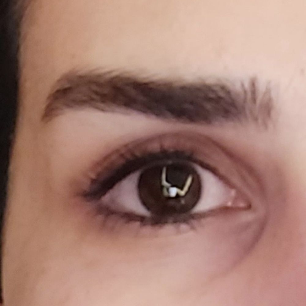 AvA