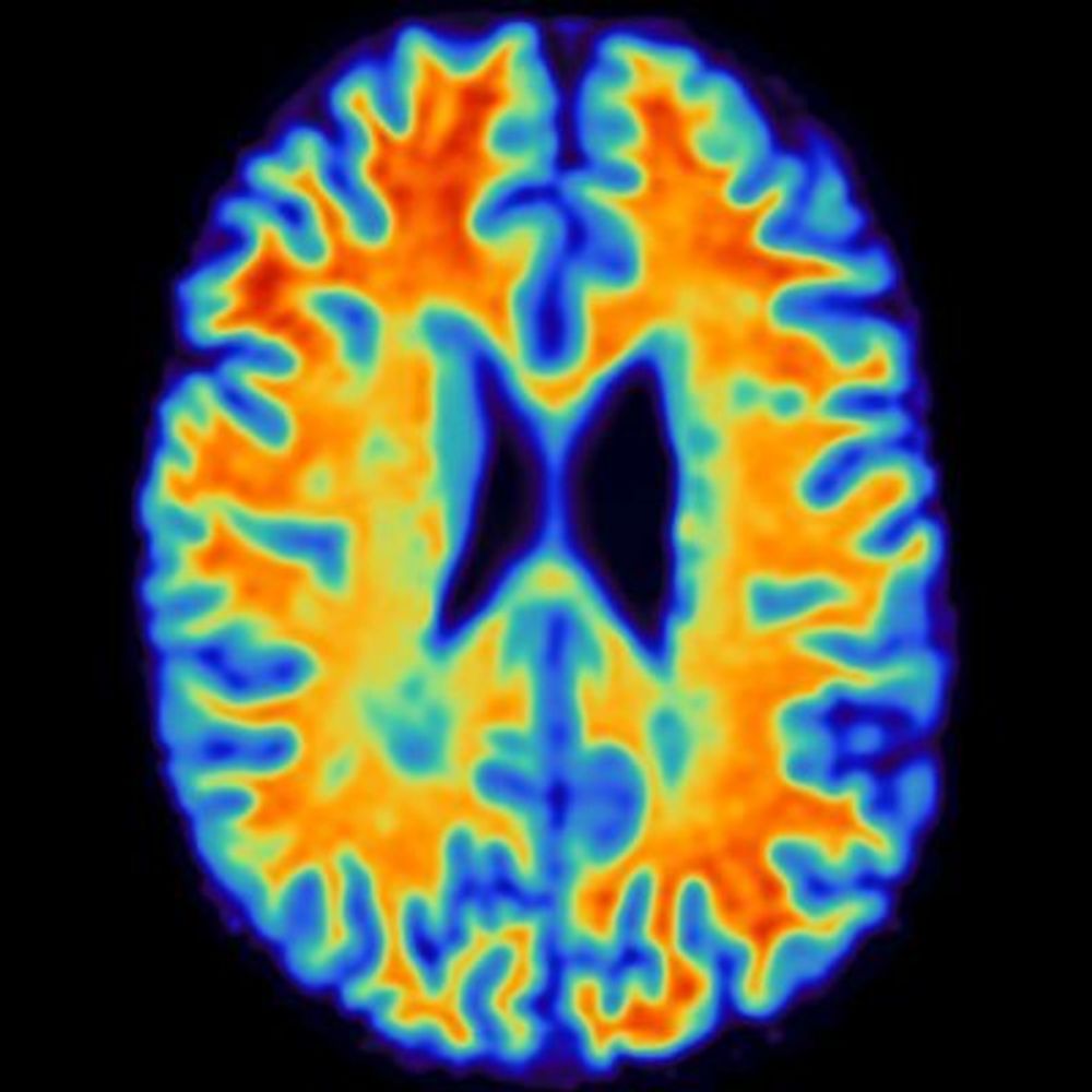 Multiple Sclerosis Imaging Lab