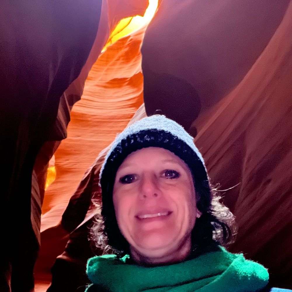 Lisa Baumann Kreuziger, MD