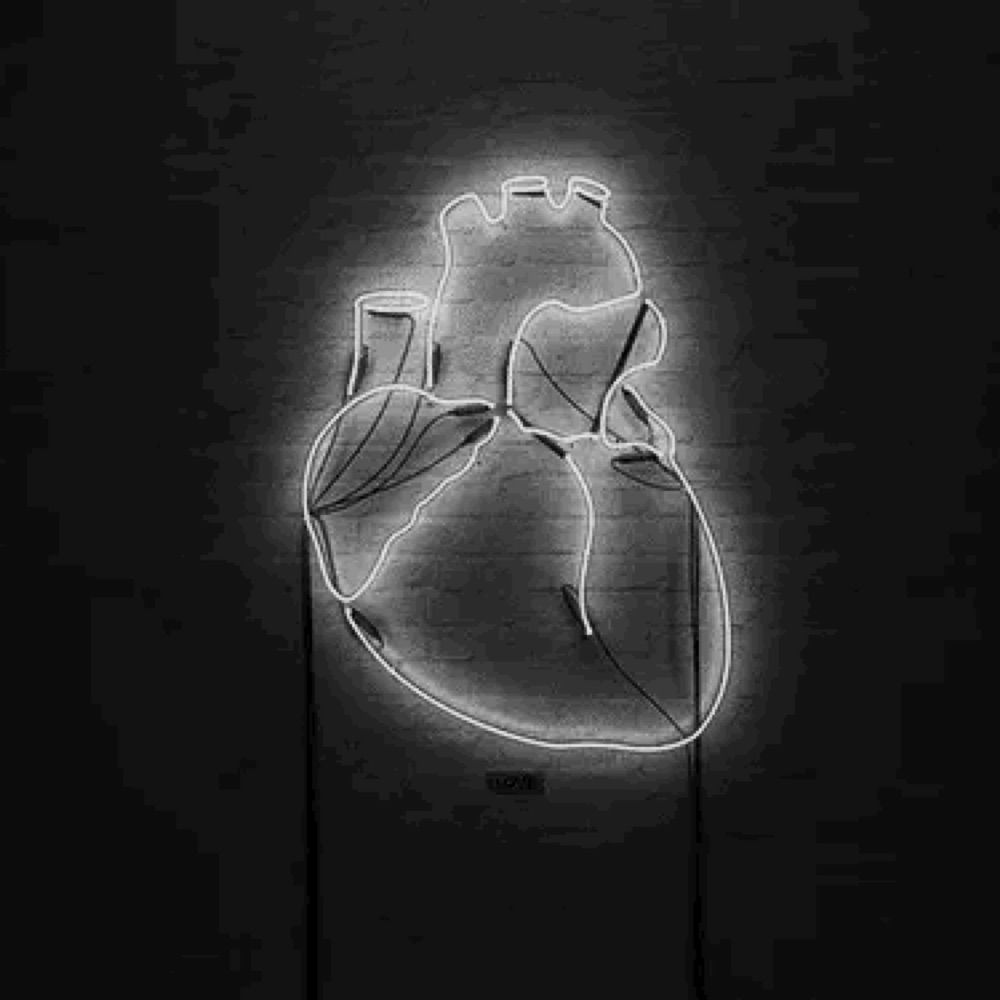 sinus tach
