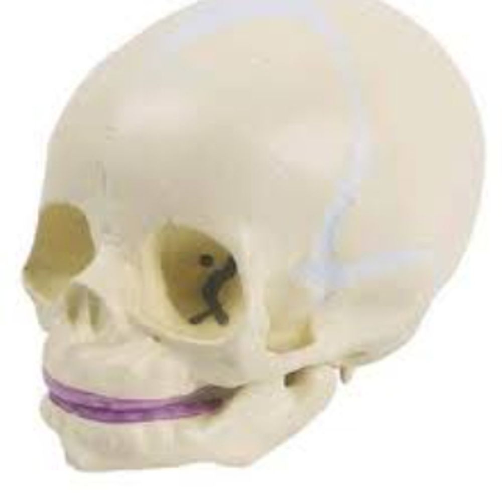 SkullBaby