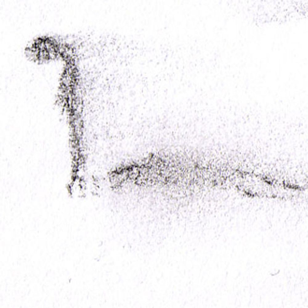 Unenthüllte (aka Eraser_Monolithe)