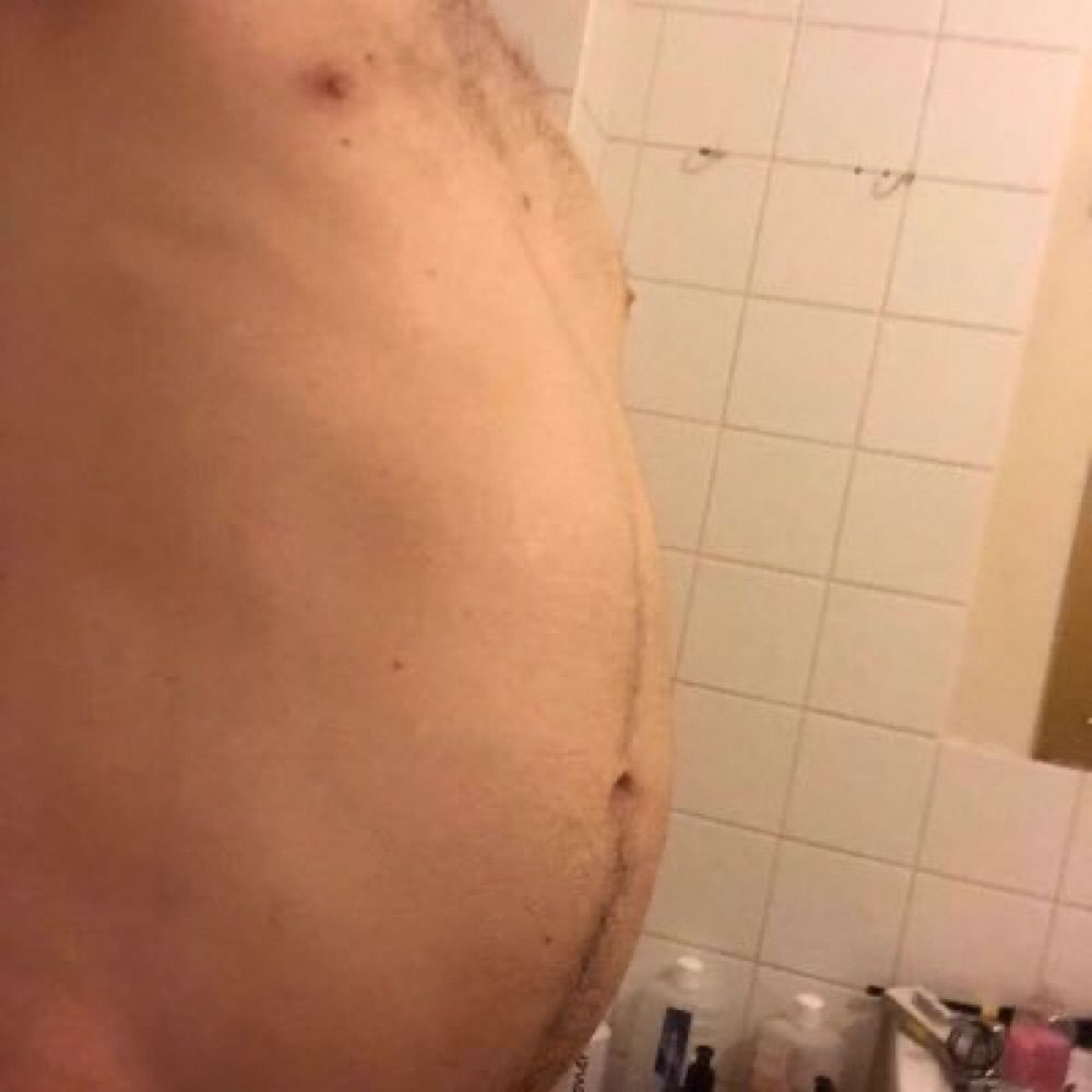 Balloonbellyboy