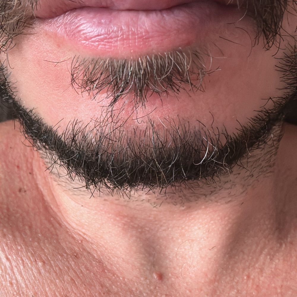 Eros Priapo