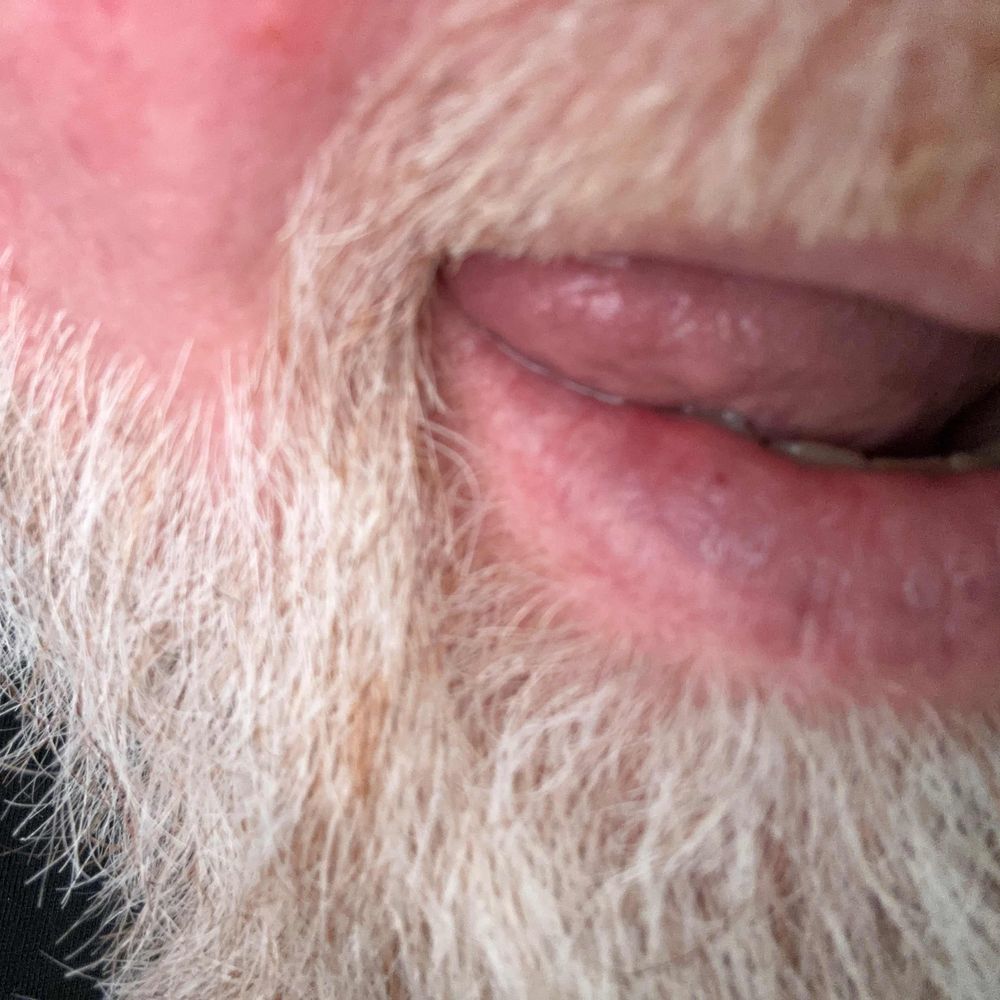 Man who swallows