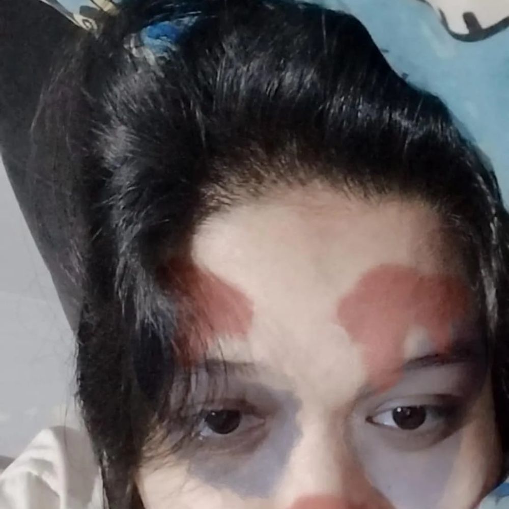 Ste