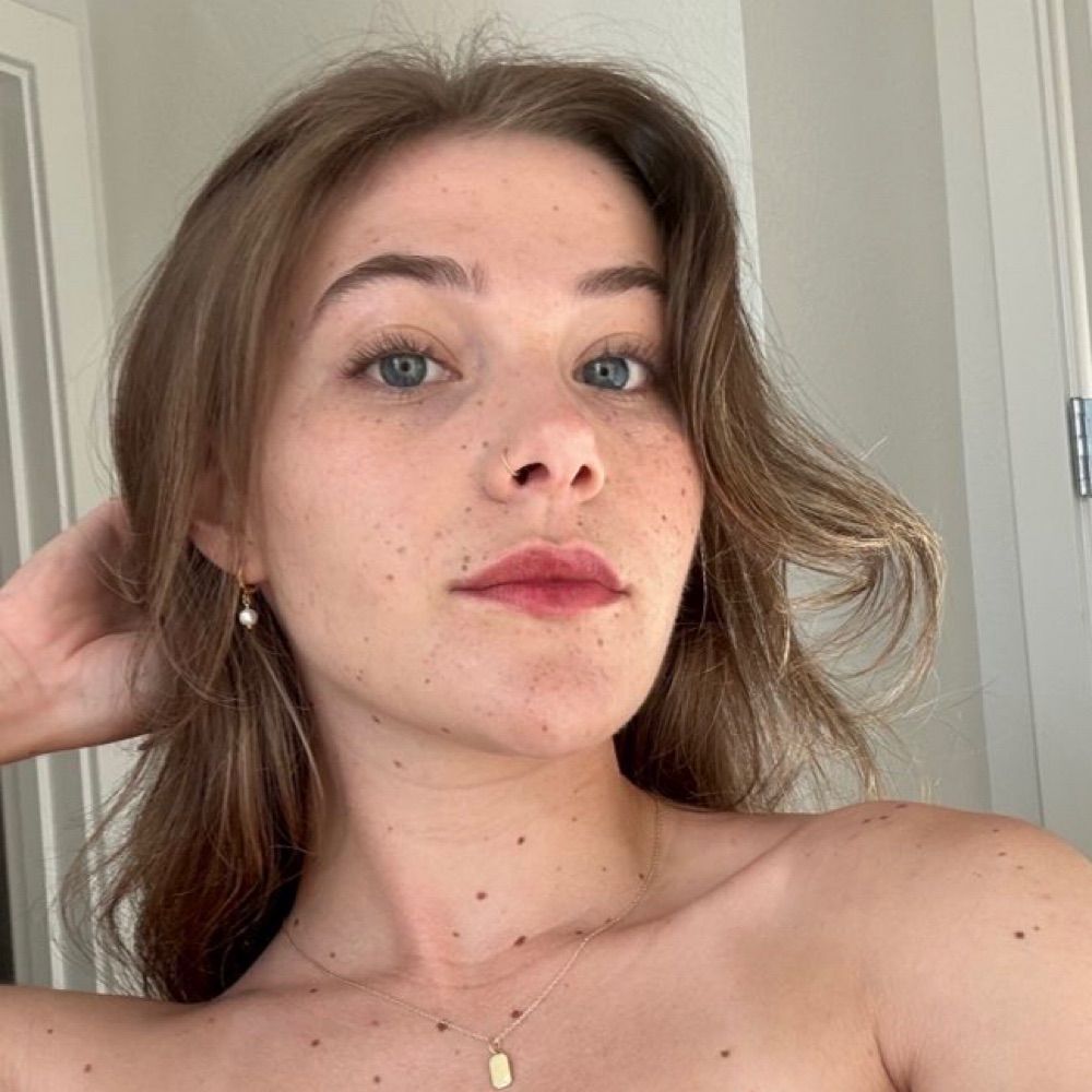 aubrey