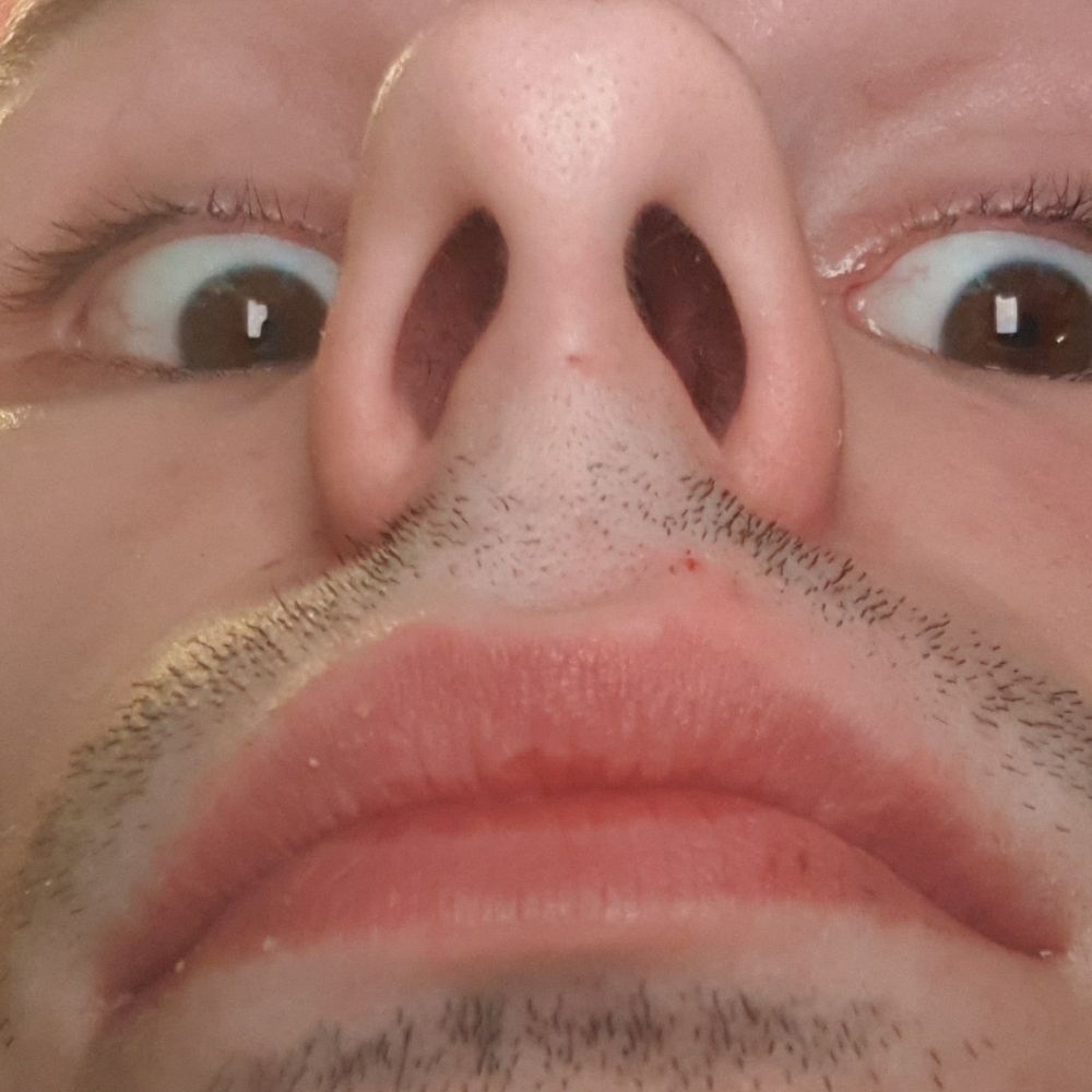 Pete