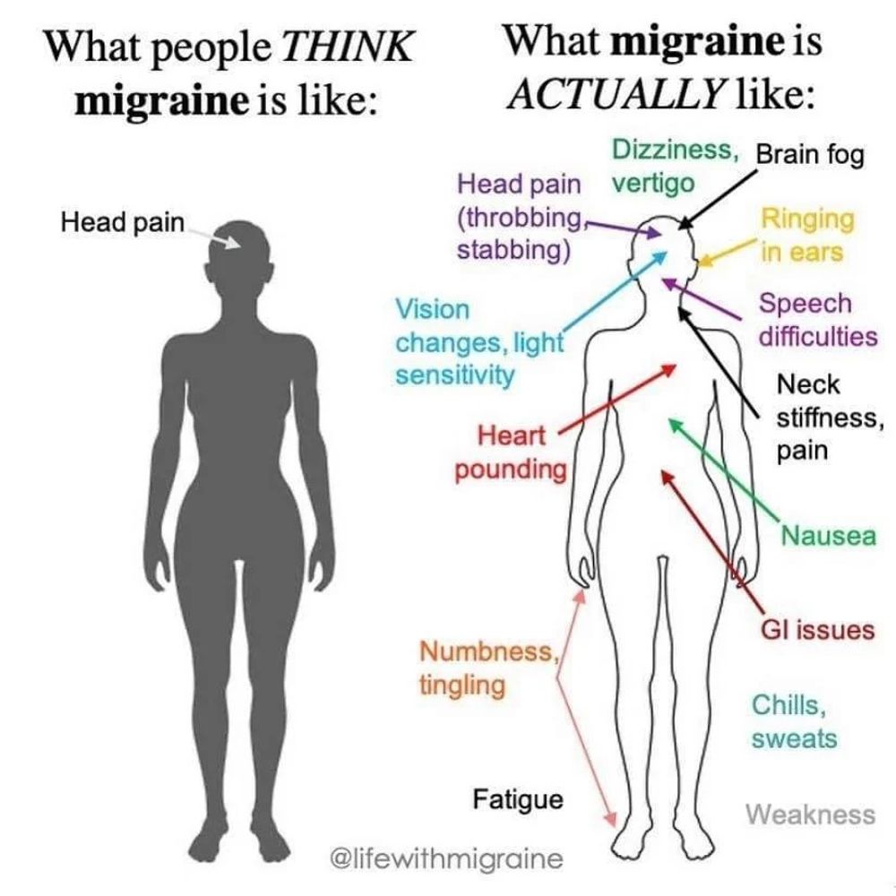 Migraines