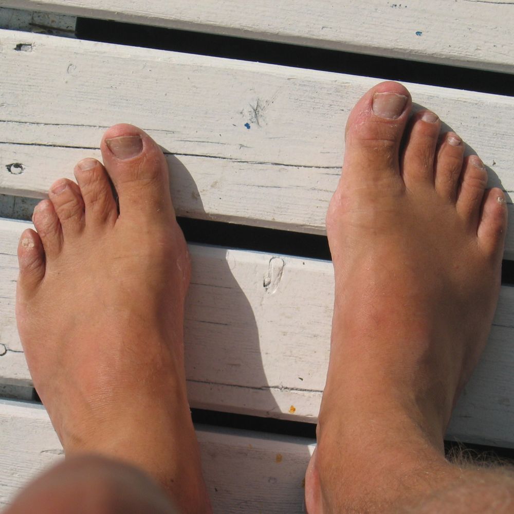 Barefoot Everywhere