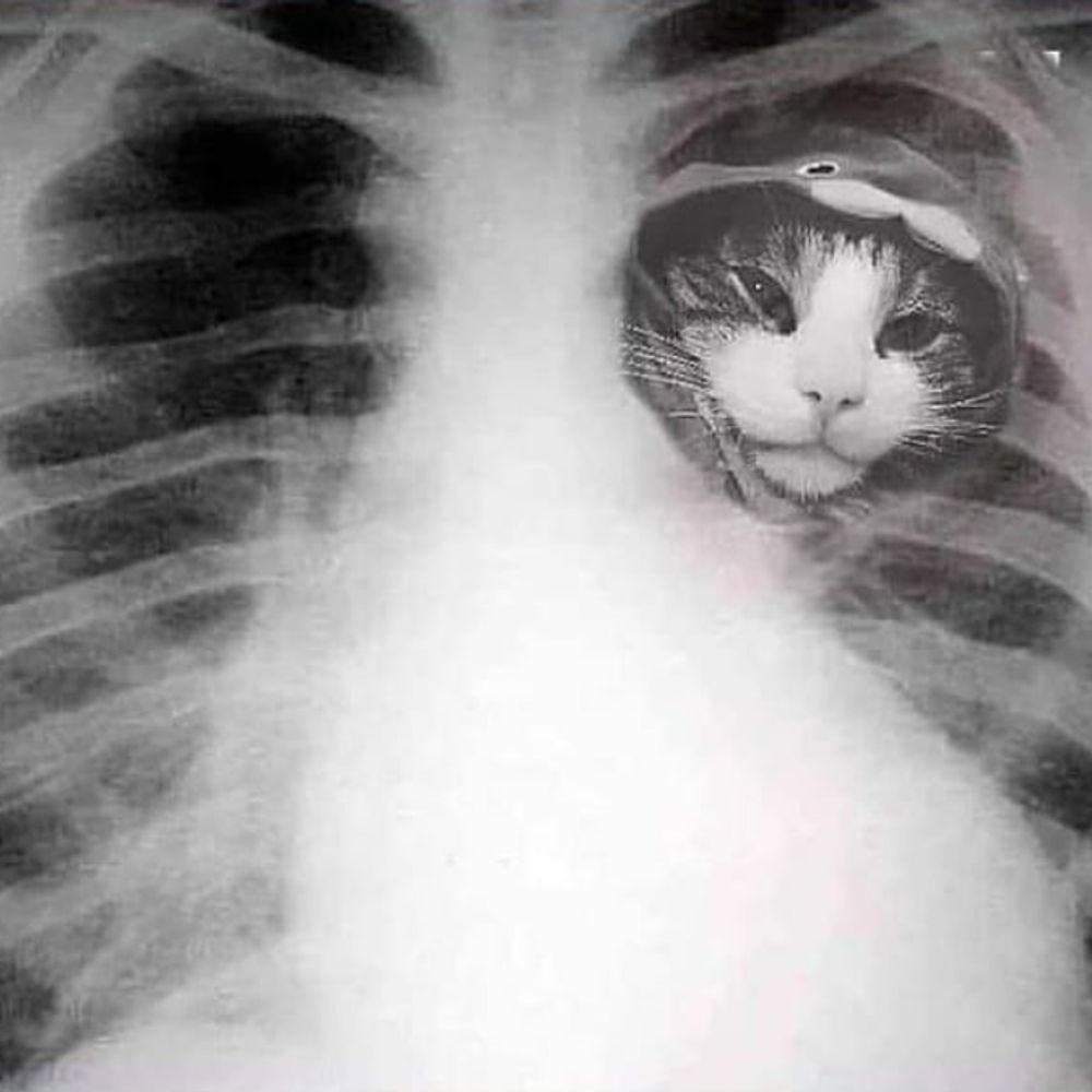 Vincent, the Neural Pruner