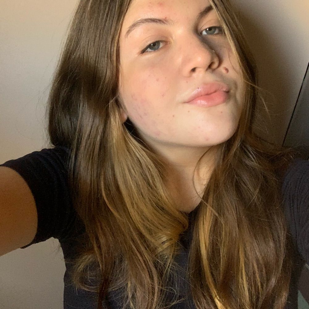 duda 