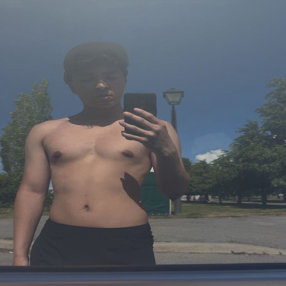 X