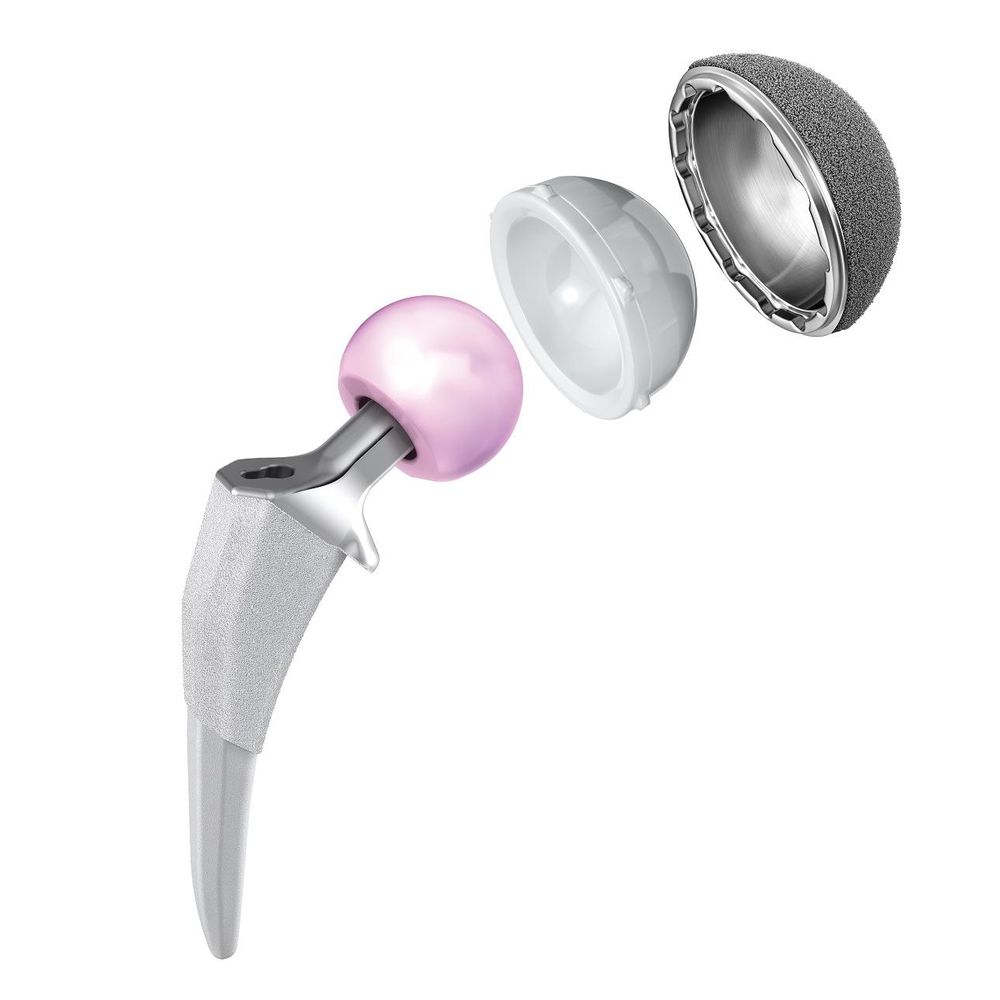 Mile High Joint Replacements
