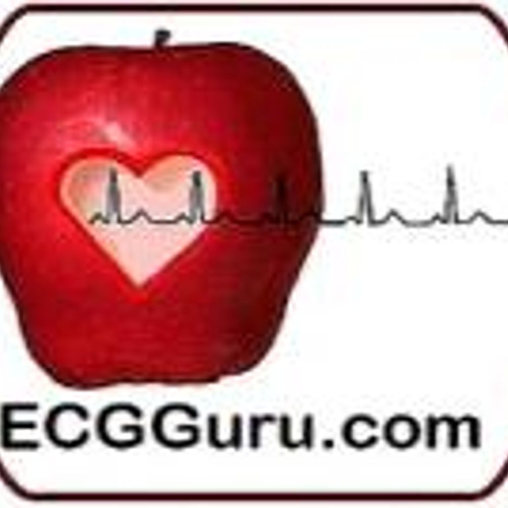 ECG Guru