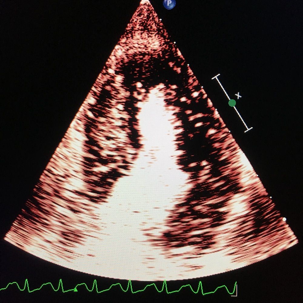 Echocardioblog