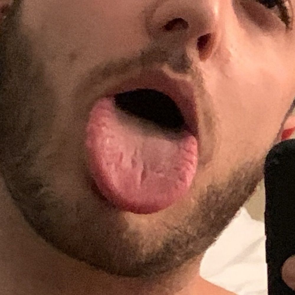 Y