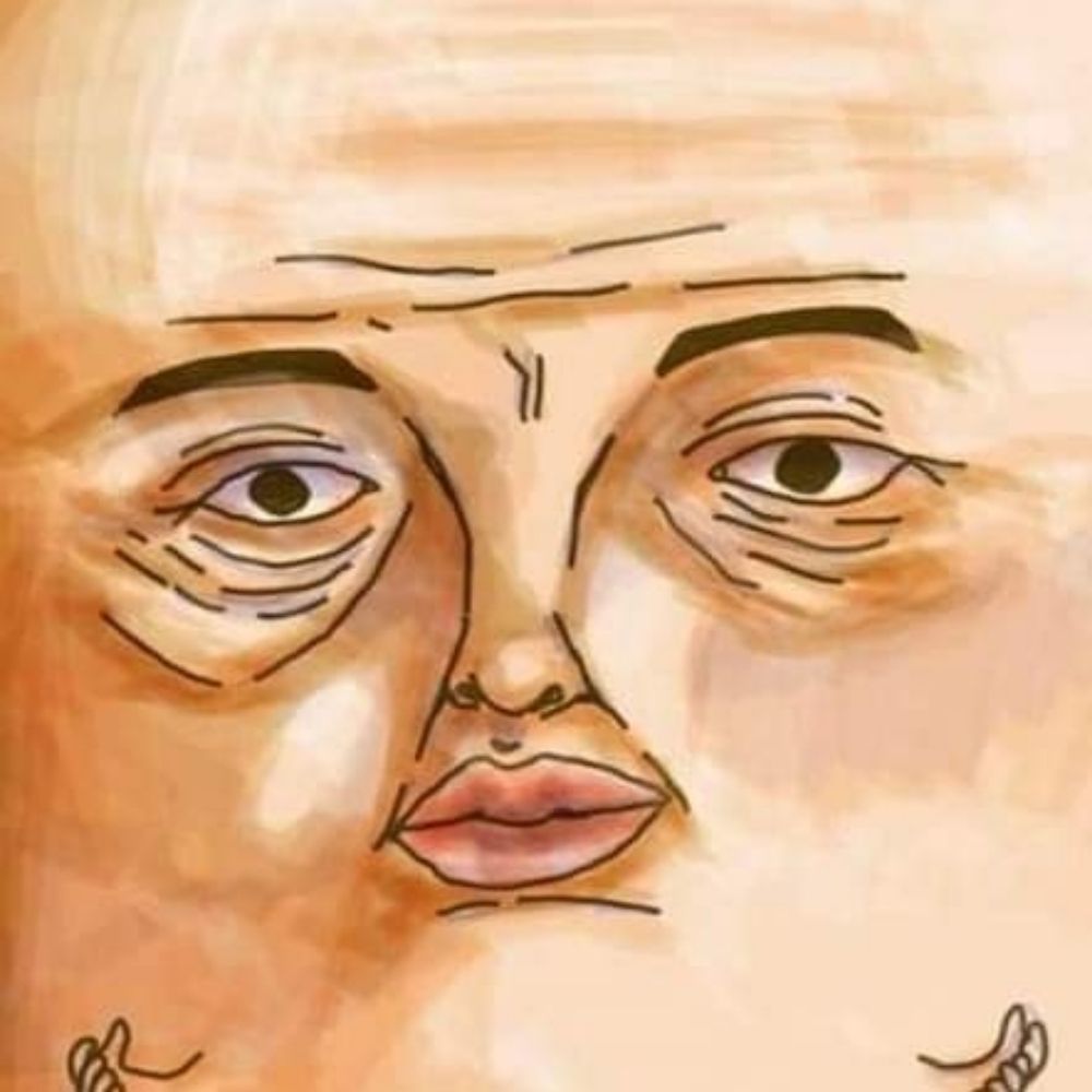 somyossu