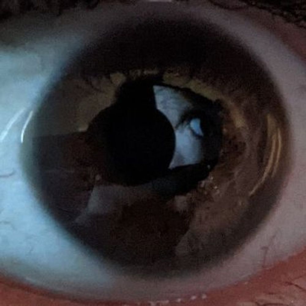 Exo the Watcher