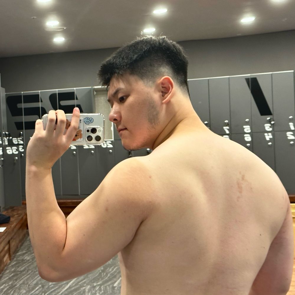 영짱