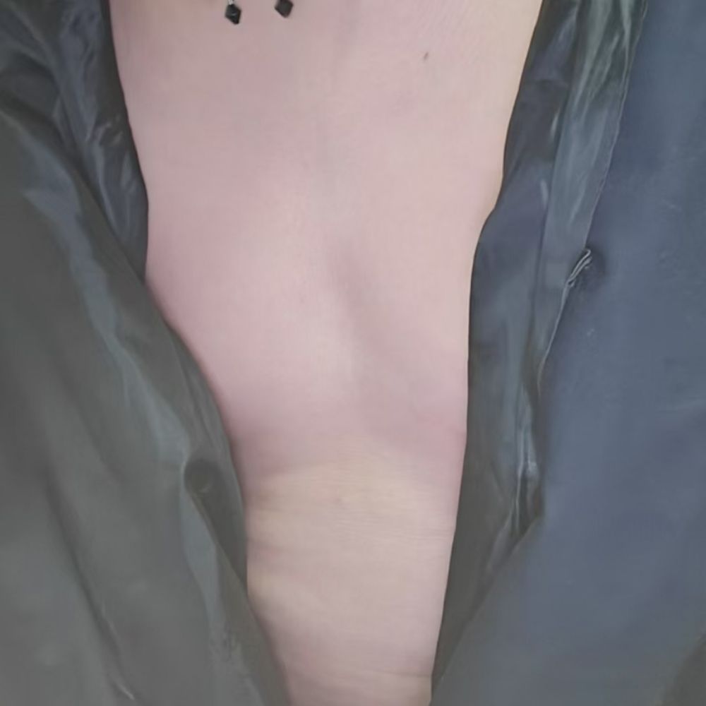 云