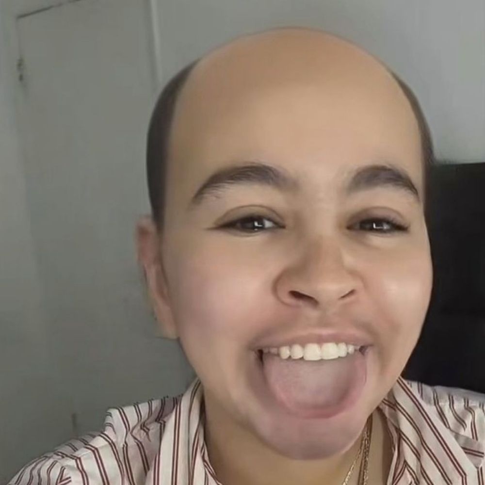Arloxcx