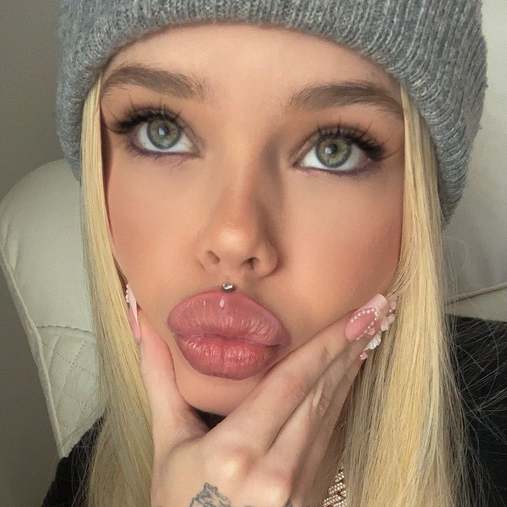 Unknown