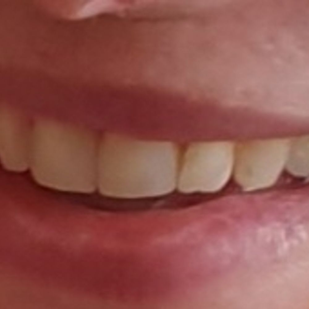Julialein