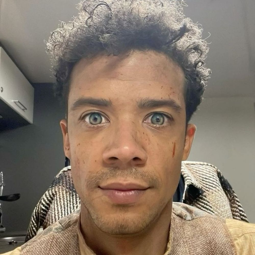 dev