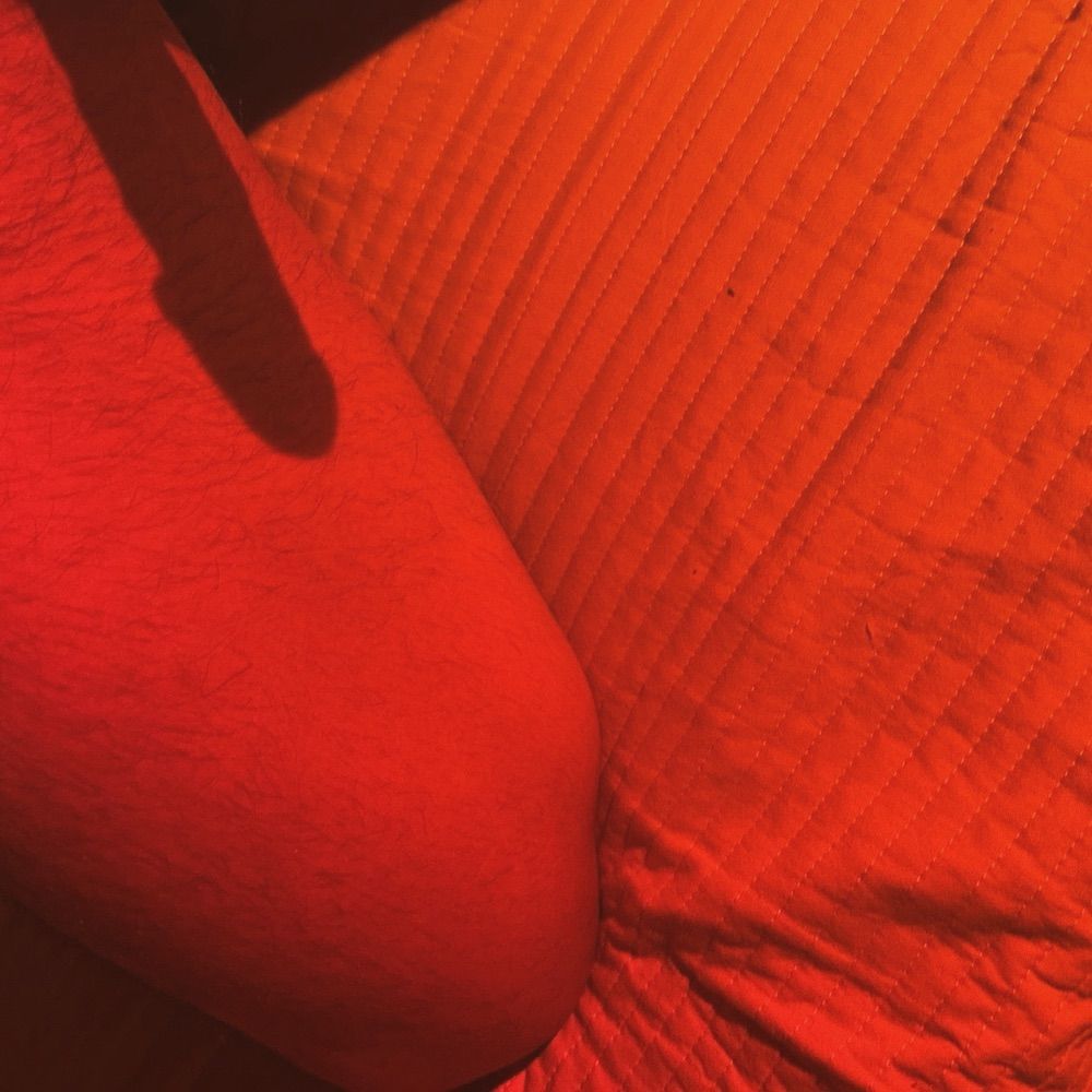 爱狗狂热者