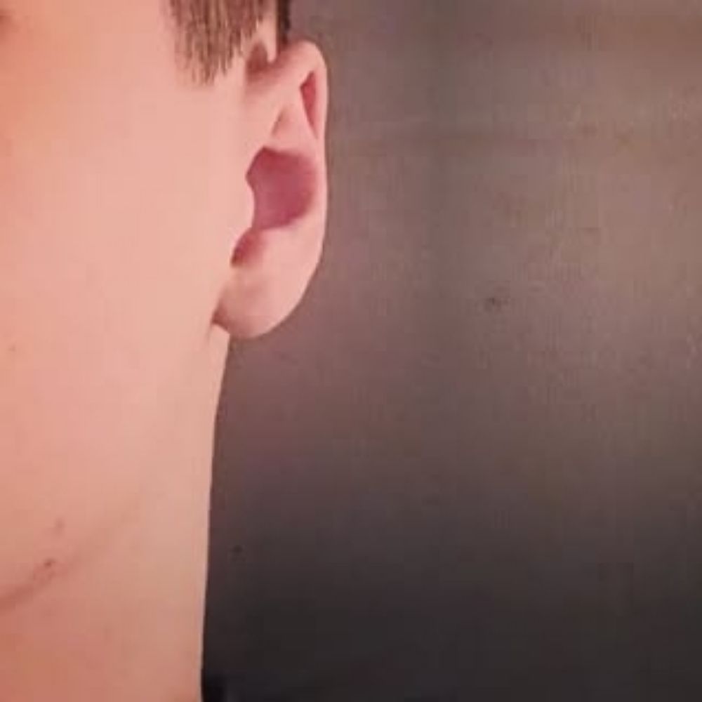 HS