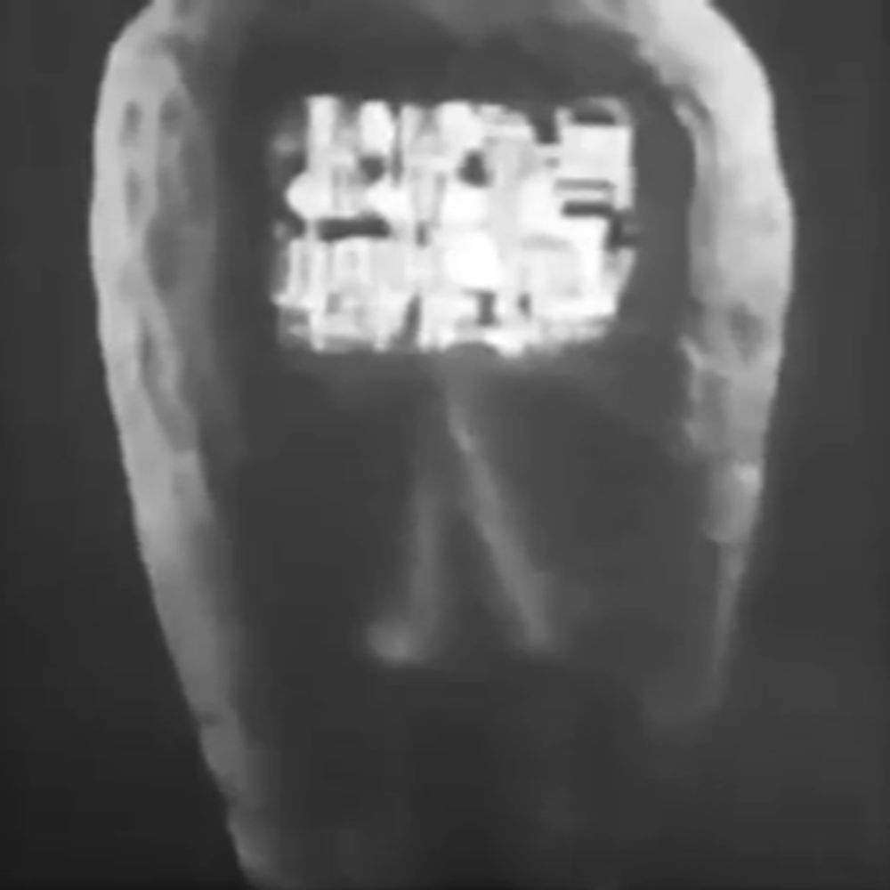 VIDEO REVACHOL