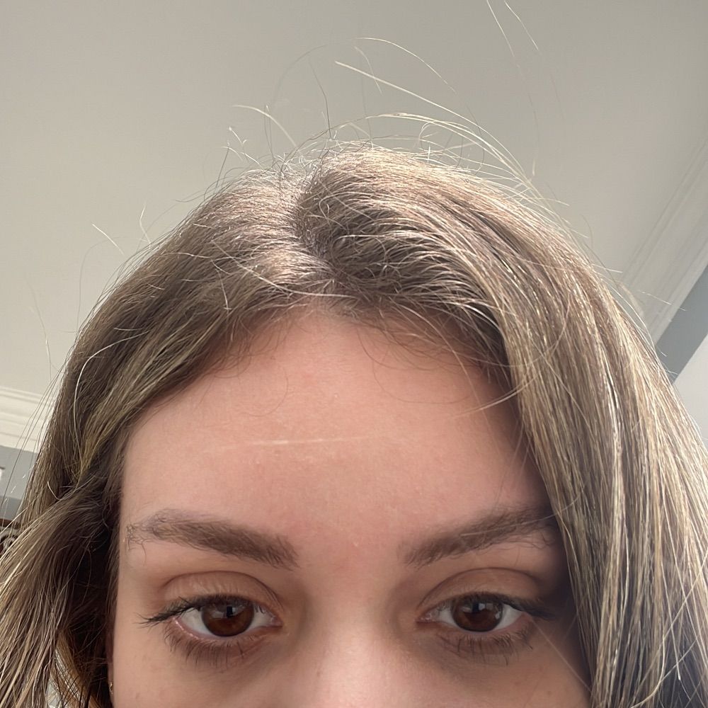 Mi 