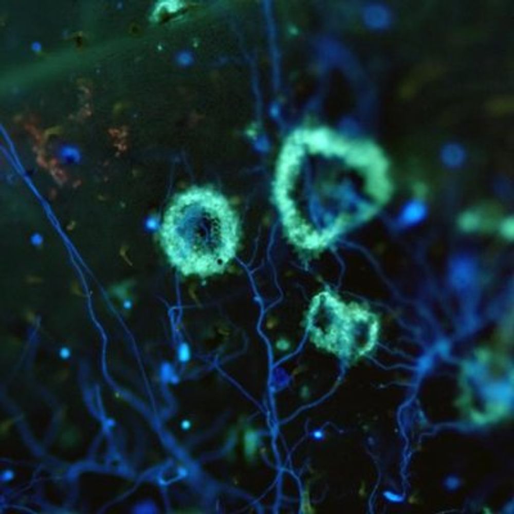 Plant Immunity and Biochemistry